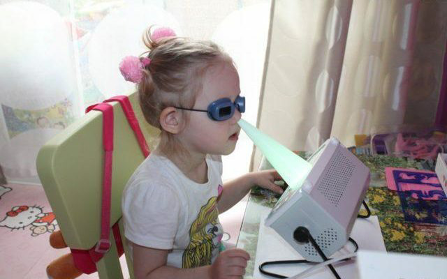 Az arcüreggyulladás kezelése kvarclámpával védőszemüveg segítségével.