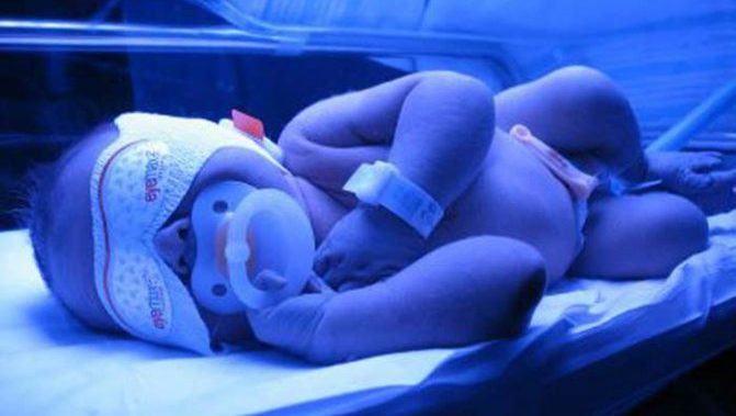 Opis i zasada działania lampy z żółtaczką