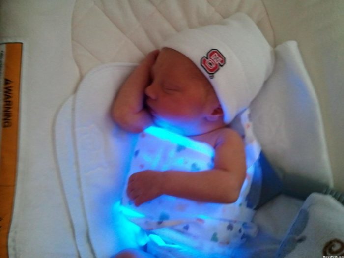 Opis i zasada działania lampy z żółtaczką