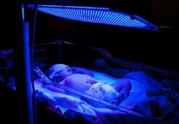 Opis i zasada działania lampy z żółtaczką